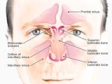 Allergic Rhinitis Symptoms and Treatment