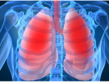 Getting to Know More about Chronic Obstructive Pulmonary Disease