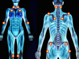 The Debilitating Symptoms of Fibromyalgia