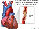 The Problems Associated with High Cholesterol