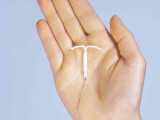 What are IUDs?